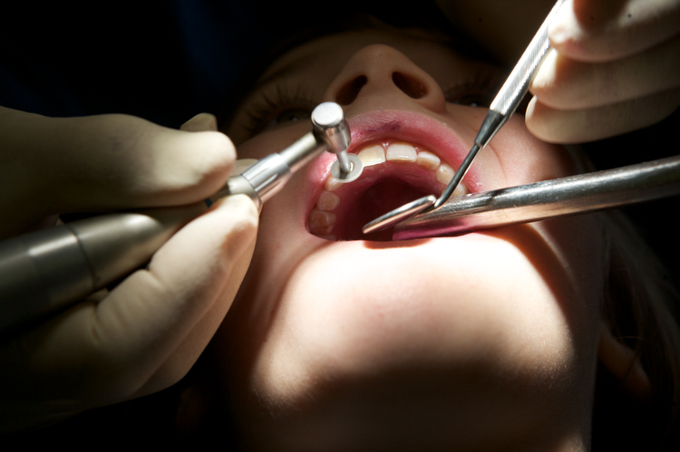 Cosmo Teeth Fixed : Dentist Harley St : London