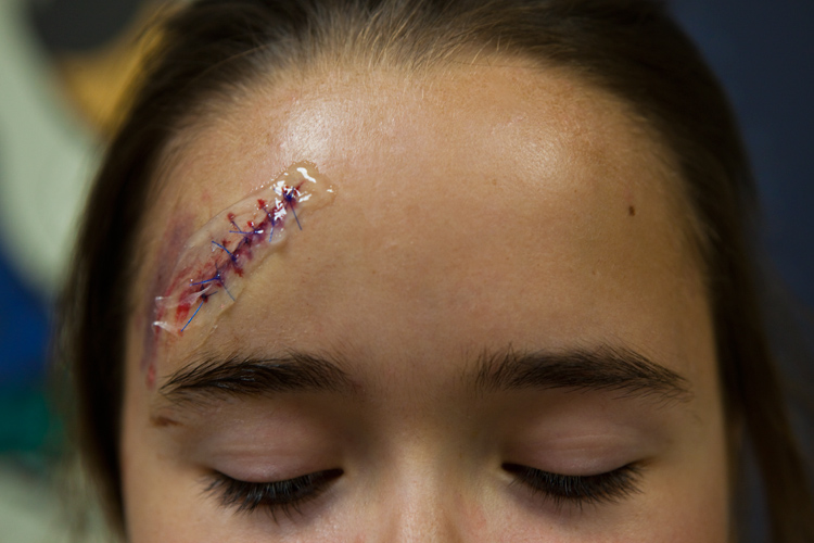 Bird with a Broken Wing : Marietta : GA