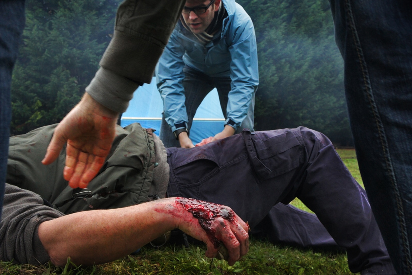 Burns Victim First Aid : Ascot : UK